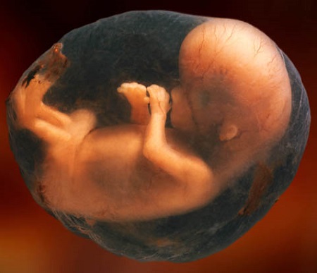 abort-8weeks.jpg