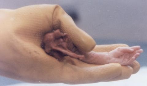 Aborted Baby's Arm Photo